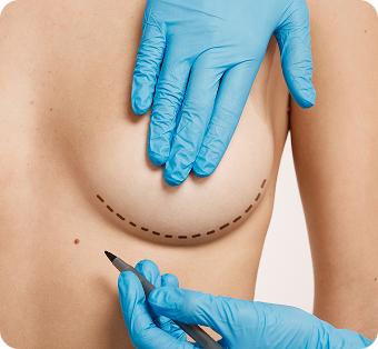 Cirurgia Plástica